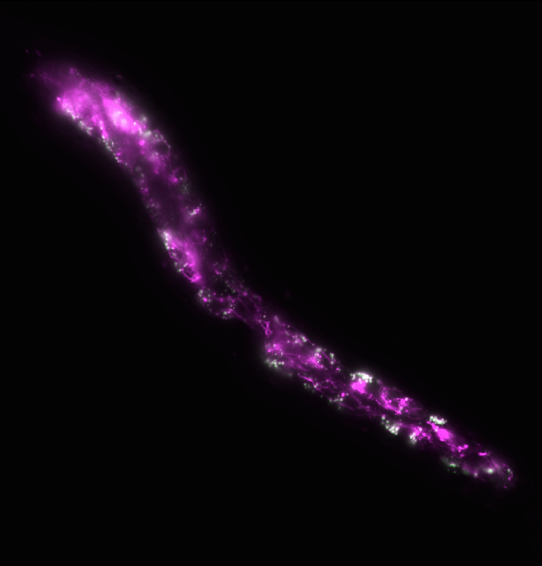 C. elegans worm expresses a fluorescent reporter 